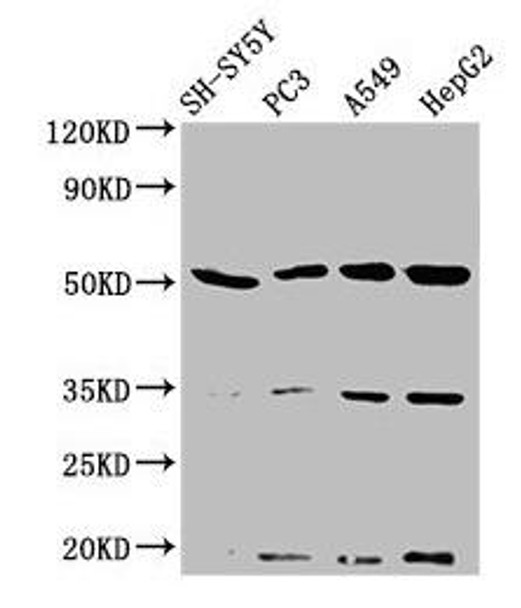 NAGPA Antibody (PACO59804)