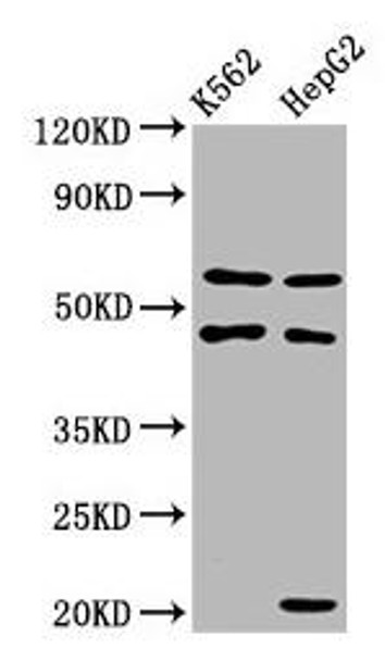 GATB Antibody (PACO59836)