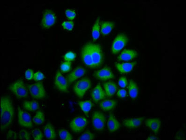 TRPM3 Antibody (PACO60396)