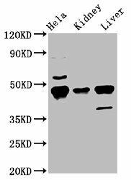 Krt18 Antibody (PACO60745)