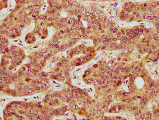 CASTOR3 Antibody (PACO61073)