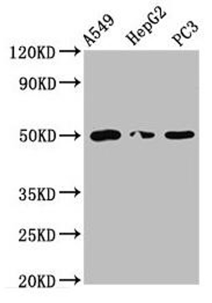 IFT52 Antibody (PACO61265)