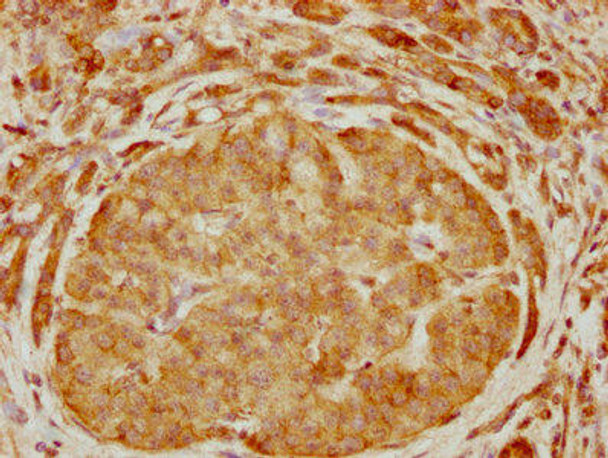 ARHGEF6 Antibody (PACO61374)