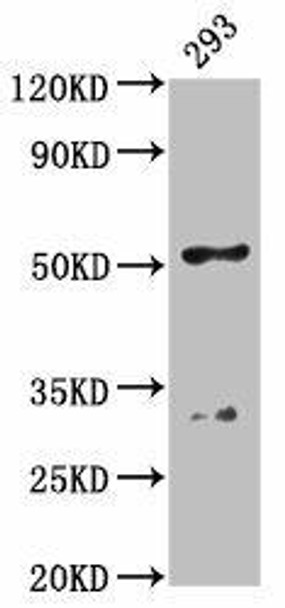 FIZ1 Antibody (PACO61430)