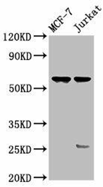 STRA8 Antibody (PACO61634)