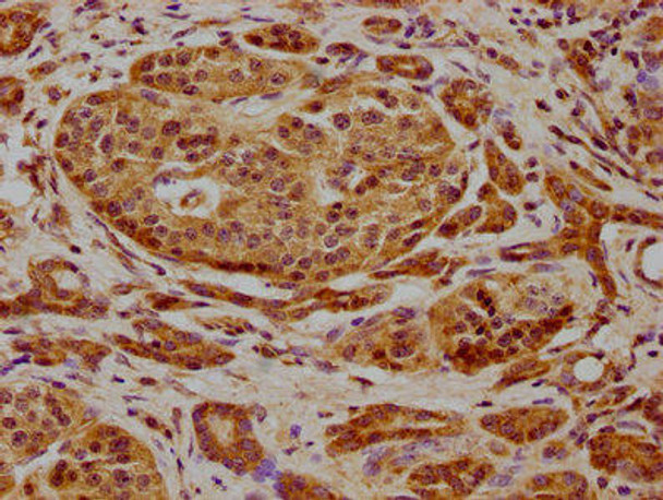 FRYL Antibody (PACO61927)
