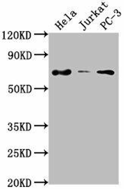 PRICKLE3 Antibody (PACO61959)