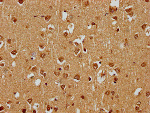 SKOR1 Antibody (PACO62419)