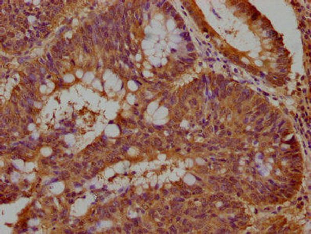 DCHS1 Antibody (PACO63471)