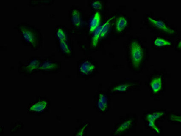 KCNMB3 Antibody (PACO63995)