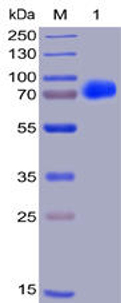 Human CS1 Recombinant Protein (hFc-His Tag) (HDPT0002)