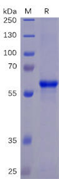 SARS-CoV-2 (2019-nCoV) S protein RBD, mFc-His Tag) (HDPT0074)