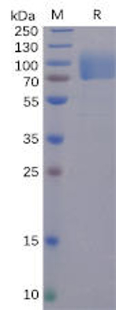 SARS-CoV-2 (2019-nCoV) S1 protein NTD, hFc Tag) (HDPT0100)