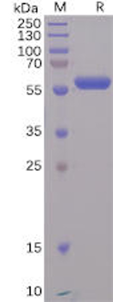 SARS-CoV-2 (2019-nCoV) S protein RBD, mFc Tag) (HDPT0102)