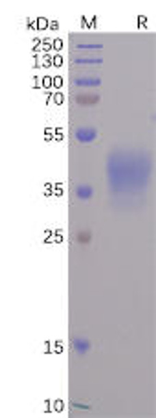 SARS-CoV-2 Spike-Membrane Recombinant Fusion Recombinant Protein (His Tag) (HDPT0103)
