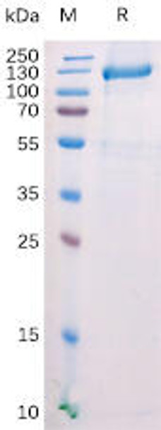 Mouse FAP Recombinant Protein (N-mFc Tag) (HDPT0158)
