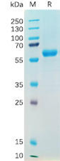 SARS-CoV-2 (2019-nCoV) S protein RBD(N501Y), hFc Tag) (HDPT0190)