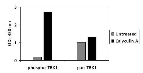 Human, Mouse and Rat Phospho-TBK1 (S172) and Total TBK1 PharmaGenie ELISA Kit (SBRS2000)