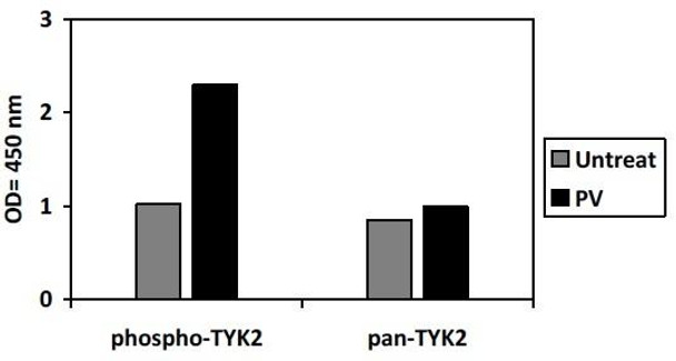 Human and Mouse Phospho-TYK2 (Y1054) and Total TYK2 PharmaGenie ELISA Kit (SBRS2010)