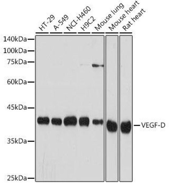 Anti-VEGF-D Antibody (CAB19242)