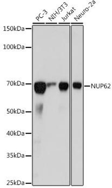 Anti-NUP62 Antibody (CAB19271) Anti-NUP62 Antibody (CAB19271)