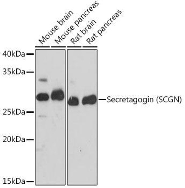 Anti-Secretagogin (SCGN) Antibody (CAB19615)