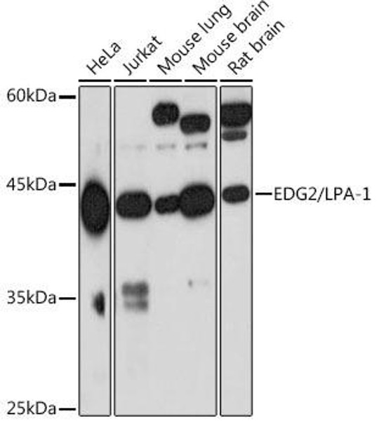 Anti-EDG2/LPA-1 Antibody (CAB19671)