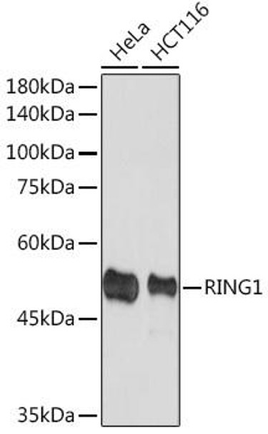 Anti-RING1A Antibody (CAB19750)