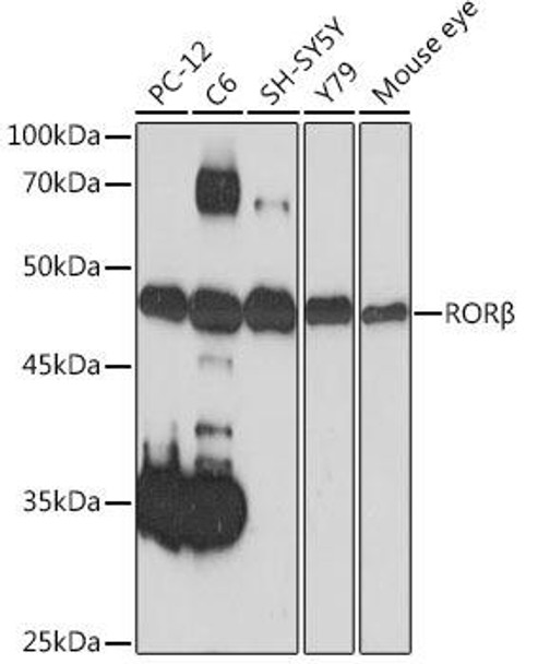 Anti-RORbeta Antibody (CAB19753)
