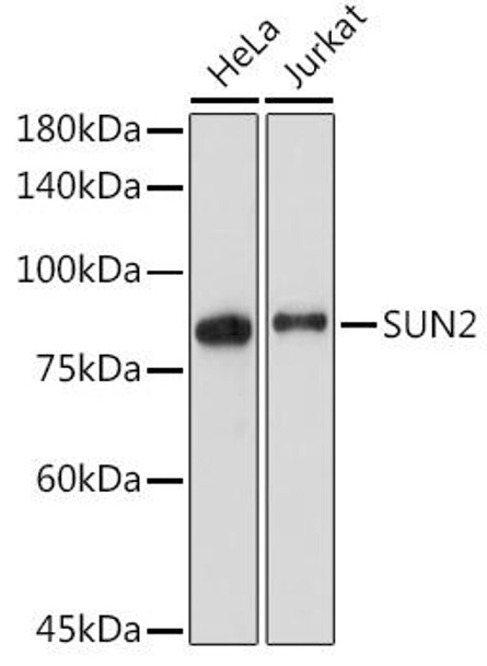 Anti-SUN2 Antibody (CAB19782)