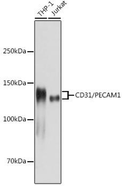 Anti-CD31/PECAM1 Antibody (CAB20228)