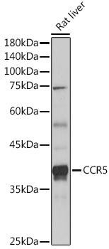 Anti-CCR5 Antibody (CAB20261)