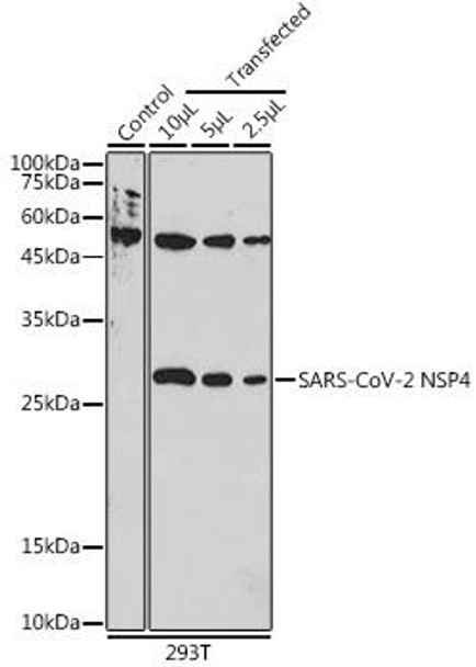 Anti-SARS-CoV-2 NSP4 Antibody (CAB20281)