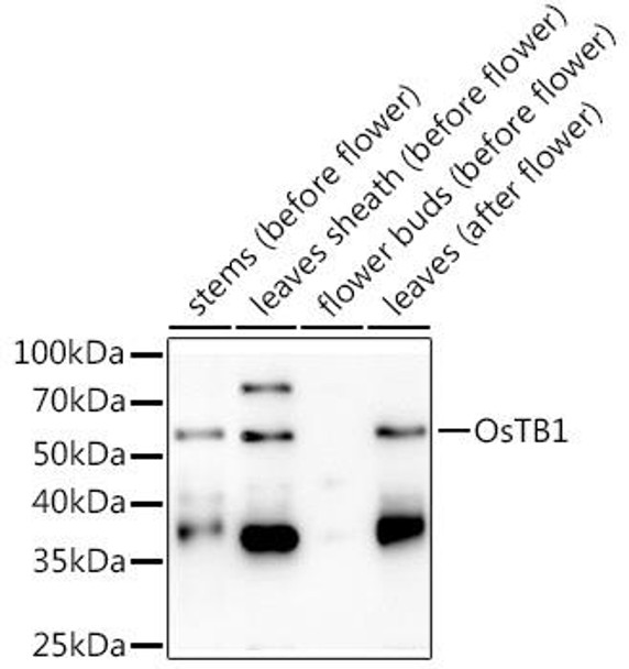 Anti-OsTB1 Antibody (CAB20349) Anti-OsTB1 Antibody (CAB20349)