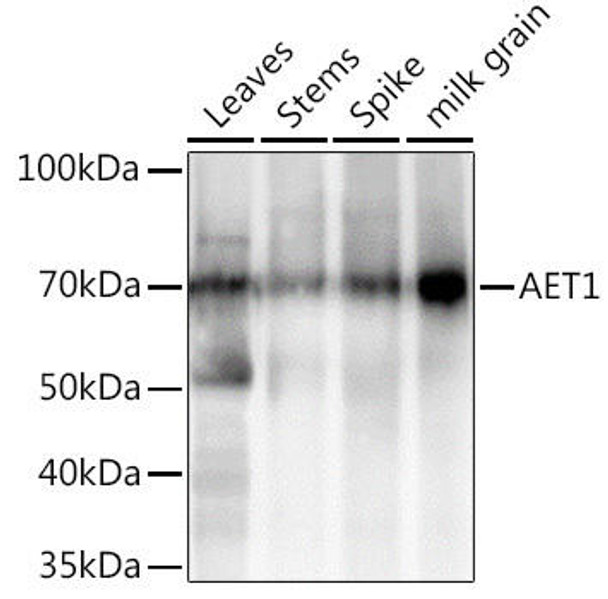 Anti-AET1 Antibody (CAB20574)