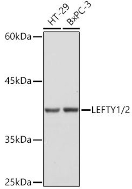 Anti-LEFTY1/2 Antibody (CAB2387)
