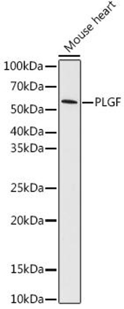 Anti-PLGF Antibody (CAB2400)