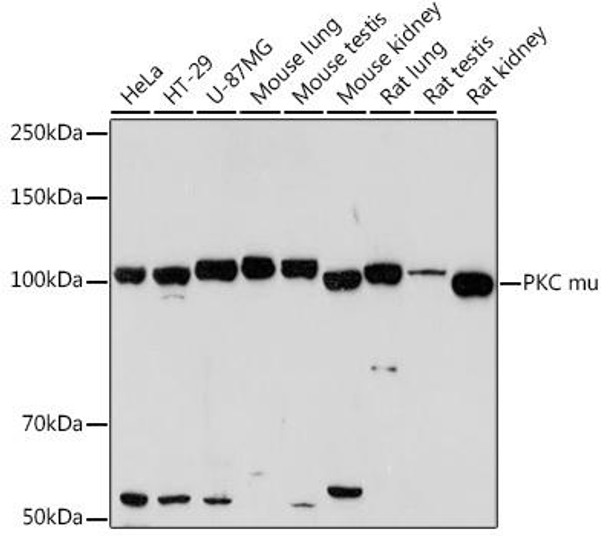 Anti-PKC mu Antibody (CAB2417)