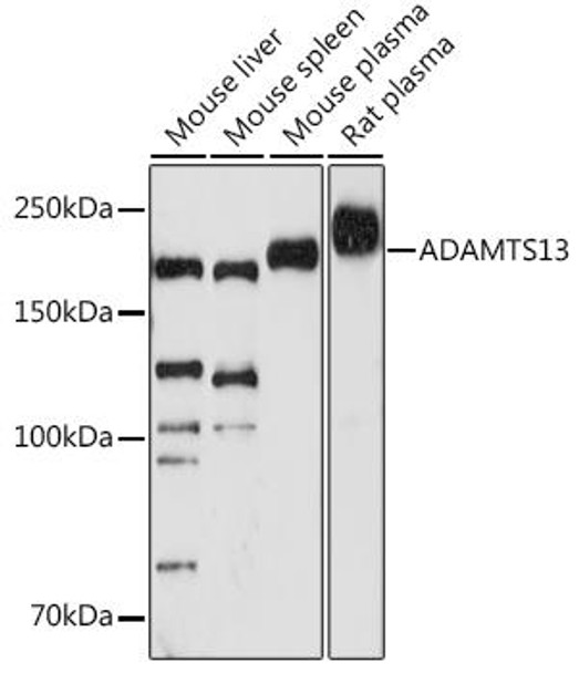 Anti-ADAMTS13 Antibody (CAB3370)