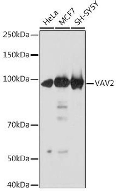 Anti-VAV2 Antibody (CAB3548)