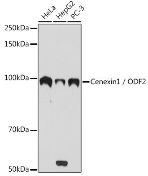 Anti-Cenexin1 / ODF2 Antibody (CAB3607)