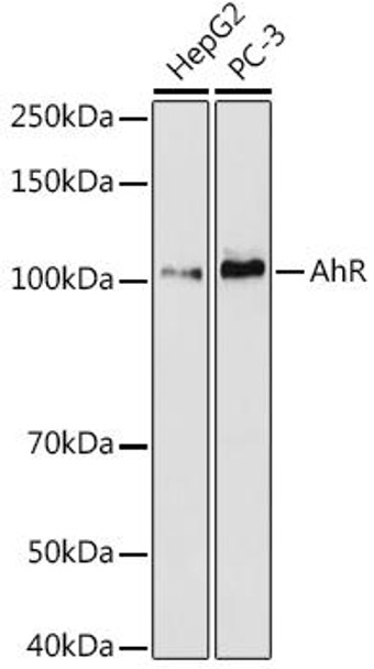 Anti-AhR Antibody (CAB4000)