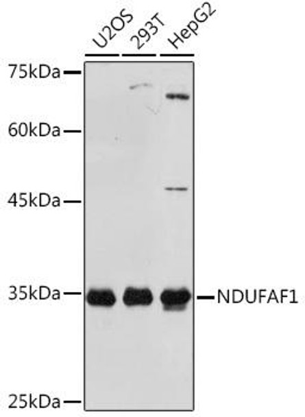 Anti-NDUFAF1 Antibody (CAB4007)