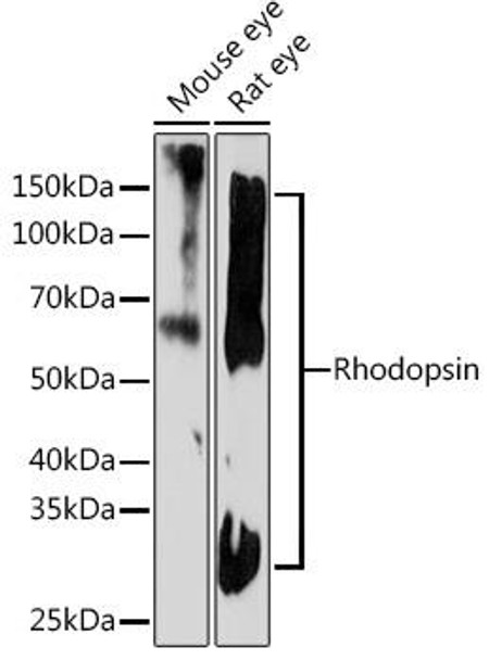 Anti-Rhodopsin Antibody (CAB7245)