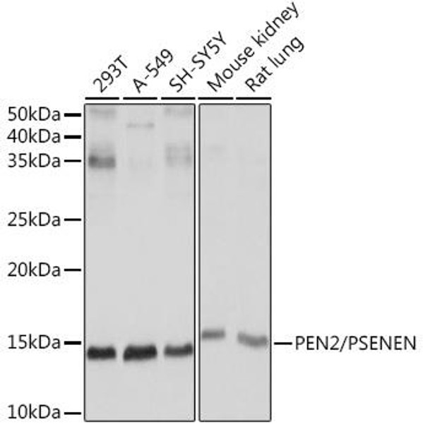 Anti-PEN2/PSENEN Antibody (CAB8678)