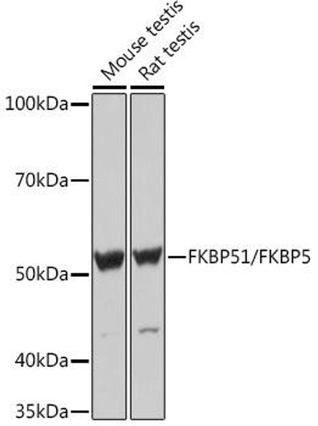 Anti-FKBP51/FKBP5 Antibody (CAB9090)