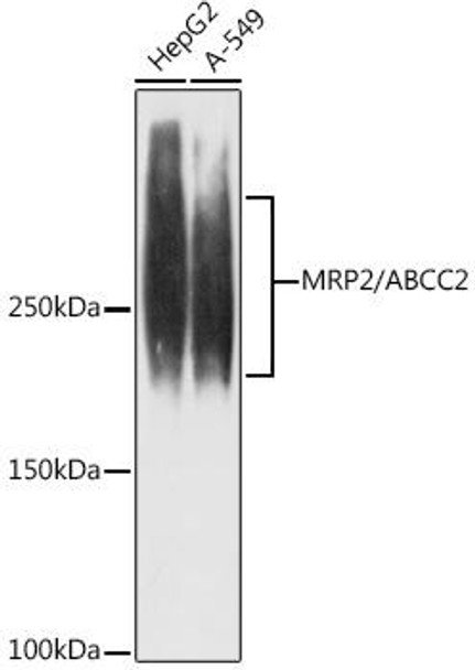 Anti-MRP2/ABCC2 Antibody (CAB9528)