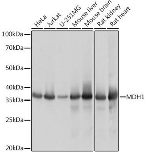 Anti-MDH1 Antibody (CAB9673)