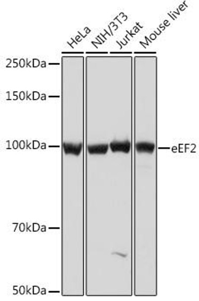 Anti-eEF2 Antibody (CAB9721)