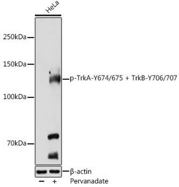 Anti-Phospho-TrkA-Y674/675 + TrkB-Y706/707 Antibody (CABP0549)